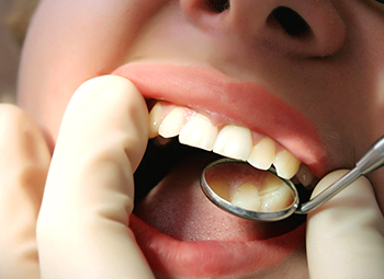 常见的口腔问题有哪些? 常见的口腔问题有哪些?