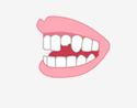 牙齿缺损